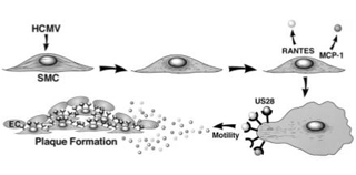 Atherosclerotic plaque formation